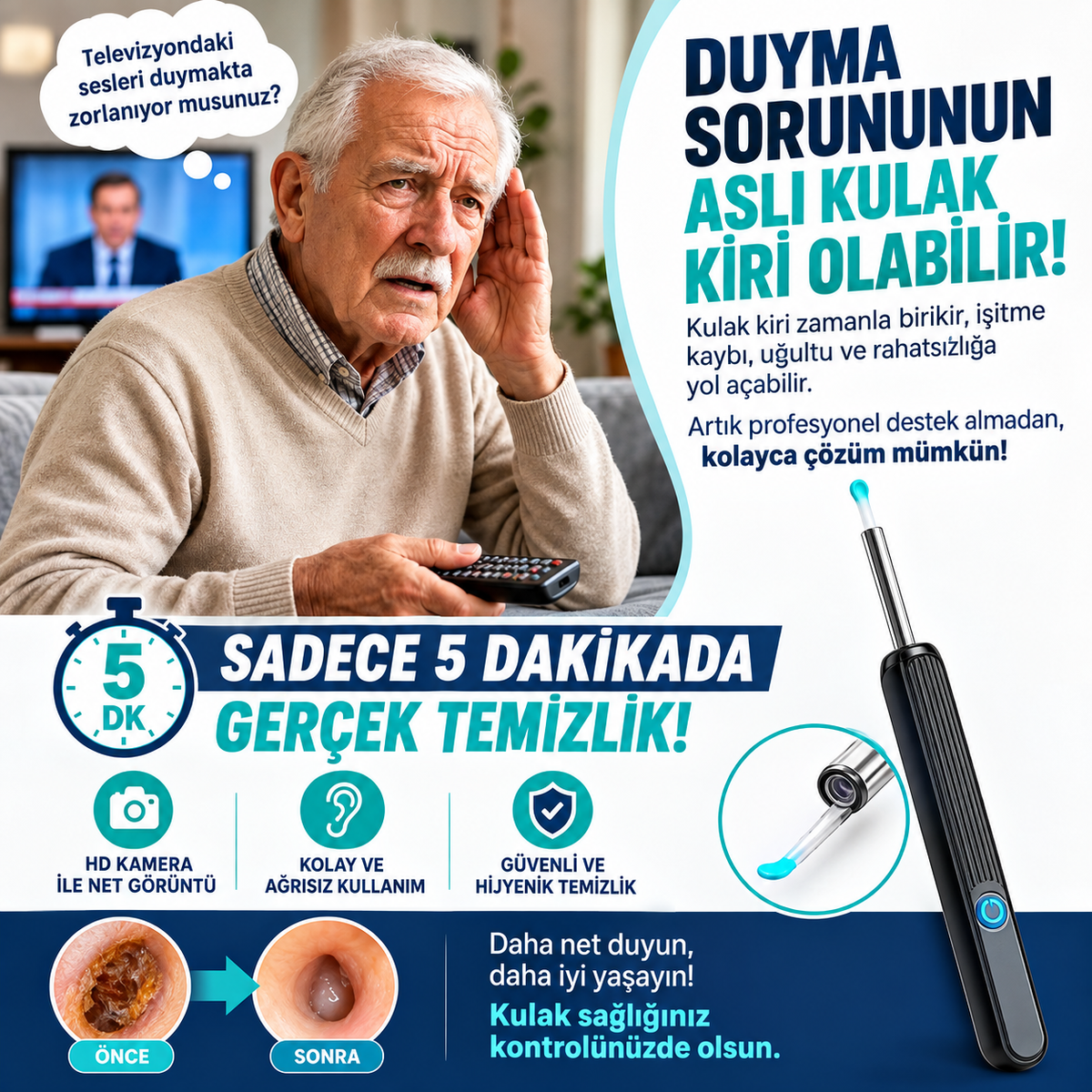 Polynix Akıllı Kulak Temizleme Seti - Telefonla Görüntülü, Kablosuz Şarjlı
