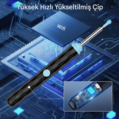 Polynix Akıllı Kulak Temizleme Seti - Telefonla Görüntülü, Kablosuz Şarjlı